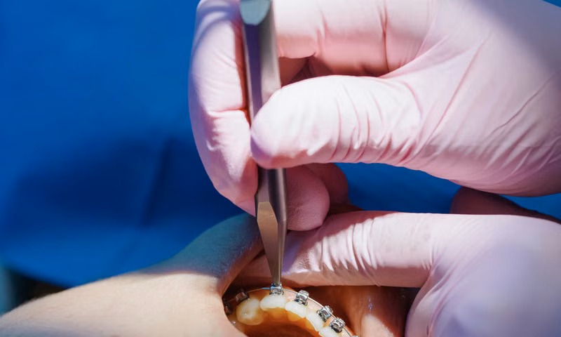 A Modern, Comfortable Path to a Straight Smile — Braces Sarjapura