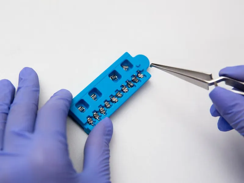 Orthodontist managing braces and Invisalign clear aligner treatment at Deekshu Dental Implant Center, Sarjapura, Bangalore