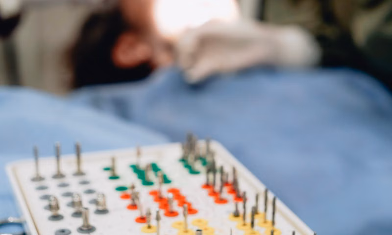 Am I a Candidate? Key Factors for Successful Implants — Dental Implants Sarjapura