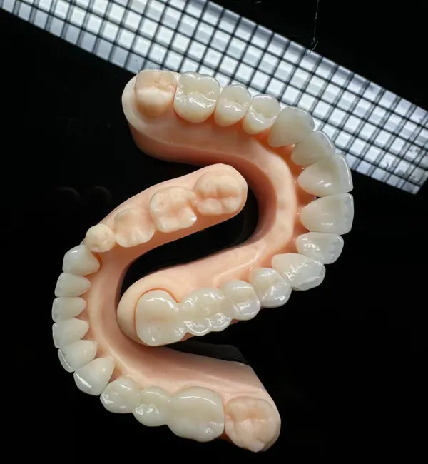 Close-up of complete denture mold showing natural tooth arrangement — custom fitting Sarjapura Bangalore