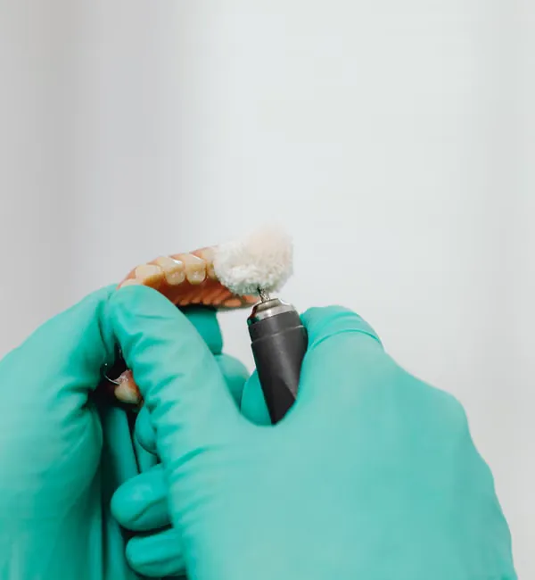 Gloved hands polishing partial denture with precision tool — quality craftsmanship Deekshu Dental Sarjapura
