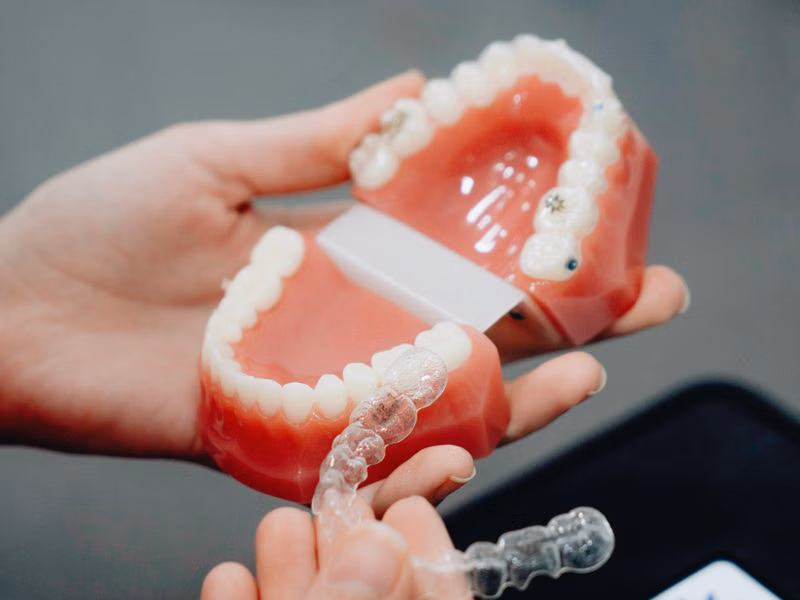 Invisalign Treatment Overview — Clear Aligners Sarjapura