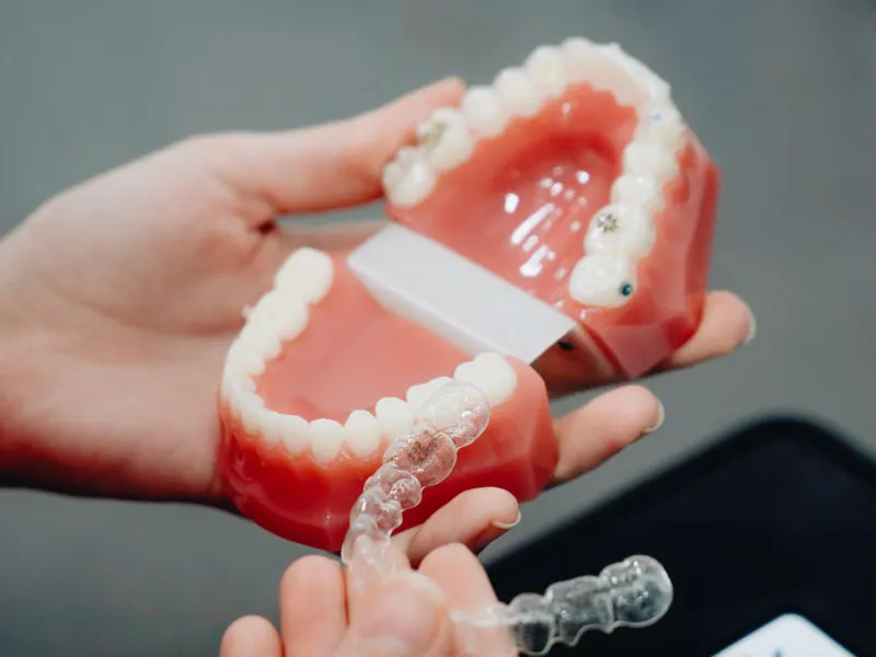 Hands holding Invisalign clear aligner trays alongside a teeth mould used for 3D digital treatment planning in Sarjapura, Bangalore