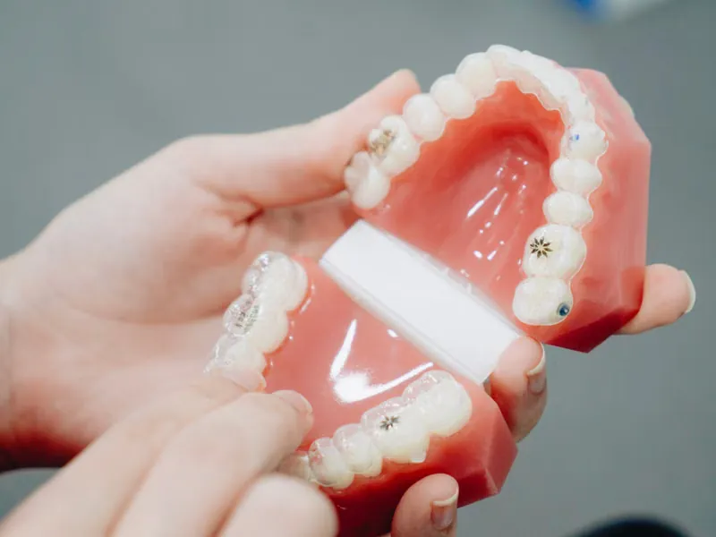Orthodontist explaining digital X-ray results for jaw surgery planning at Deekshu Dental Sarjapura Bangalore