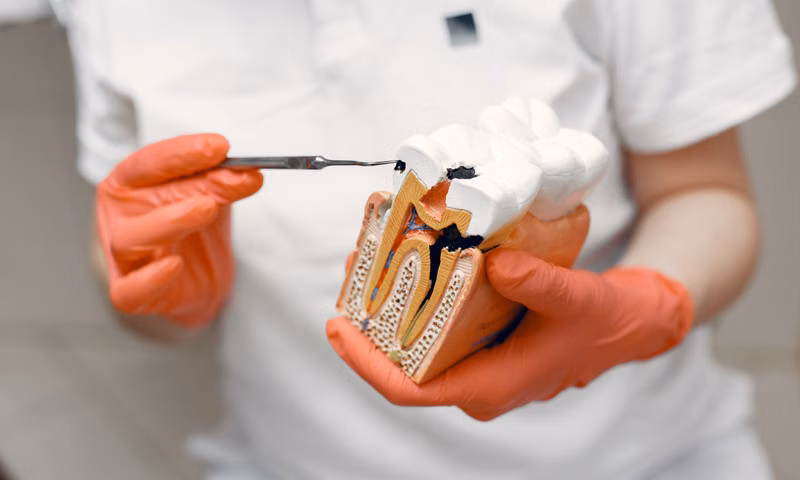 Saving Your Natural Tooth and Relieving Pain — Root Canal Treatment Sarjapura