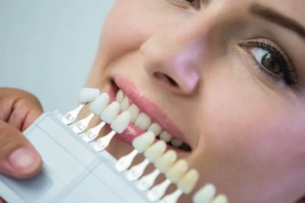 deekshu-dental-cosmeticdentistry4