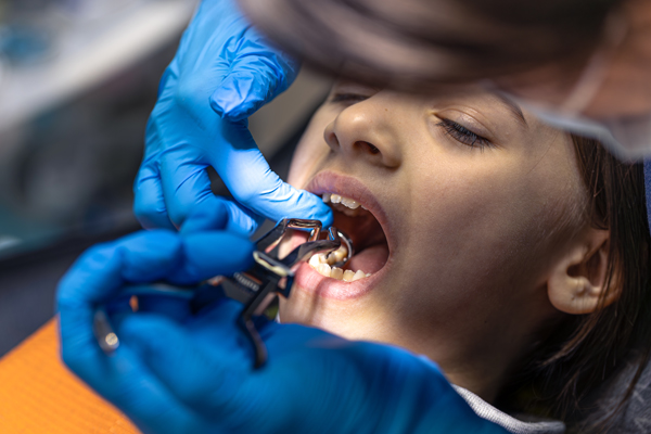 deekshu -orthodontics-8