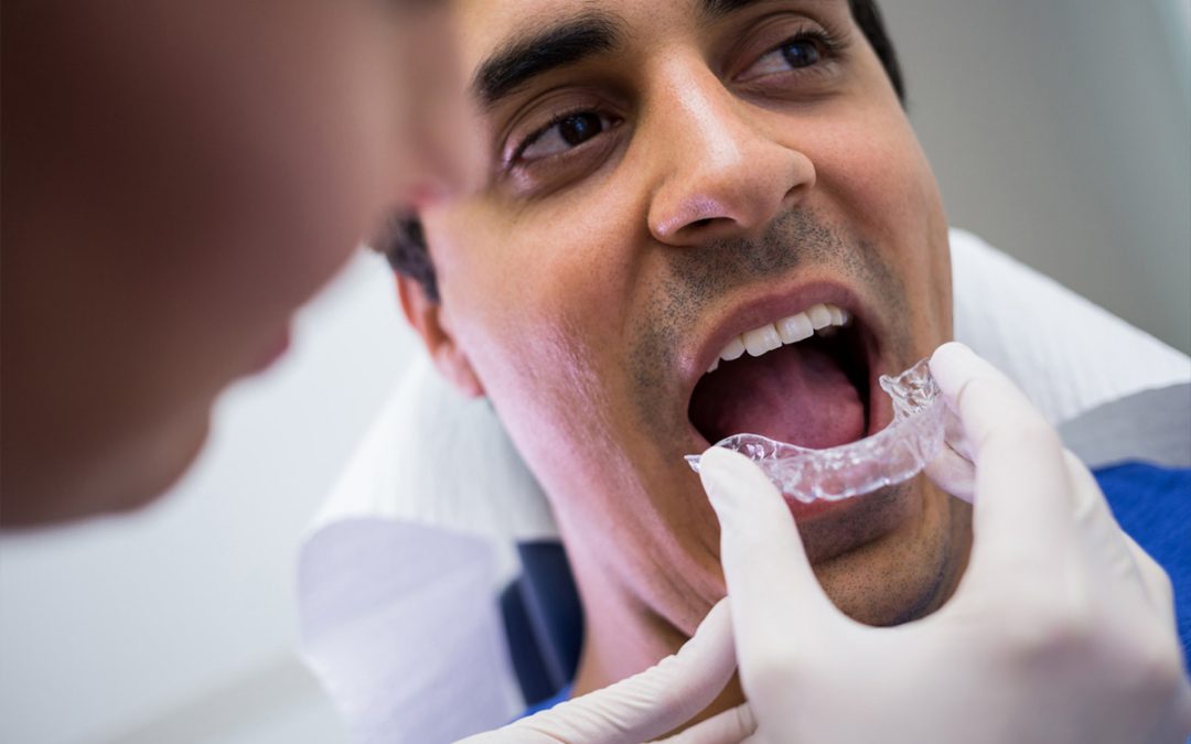 Benefits of Invisalign Treatment