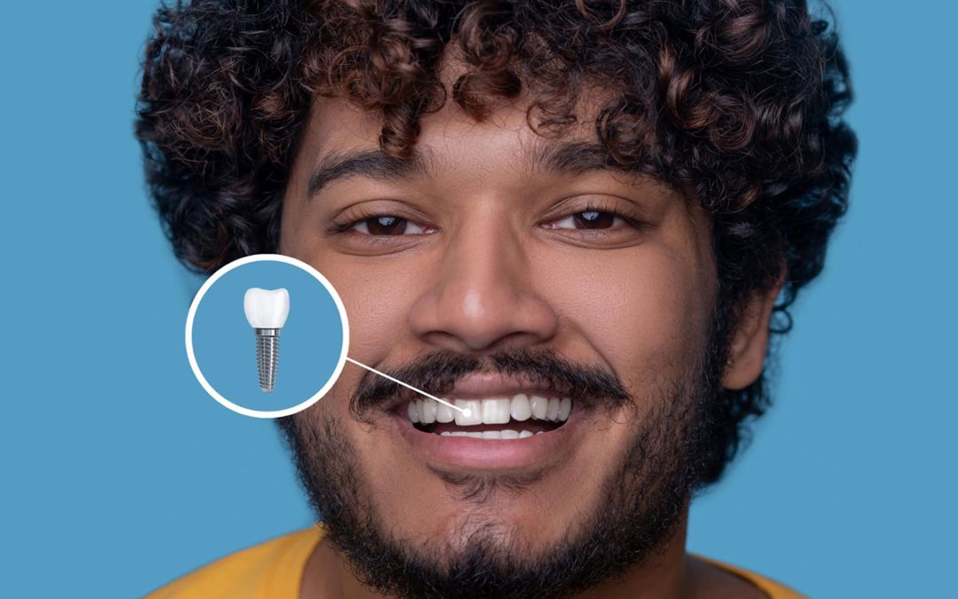 What to Expect from Start to Finish