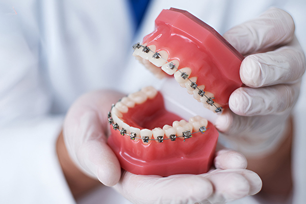 deekshudental-dental-implants-img01